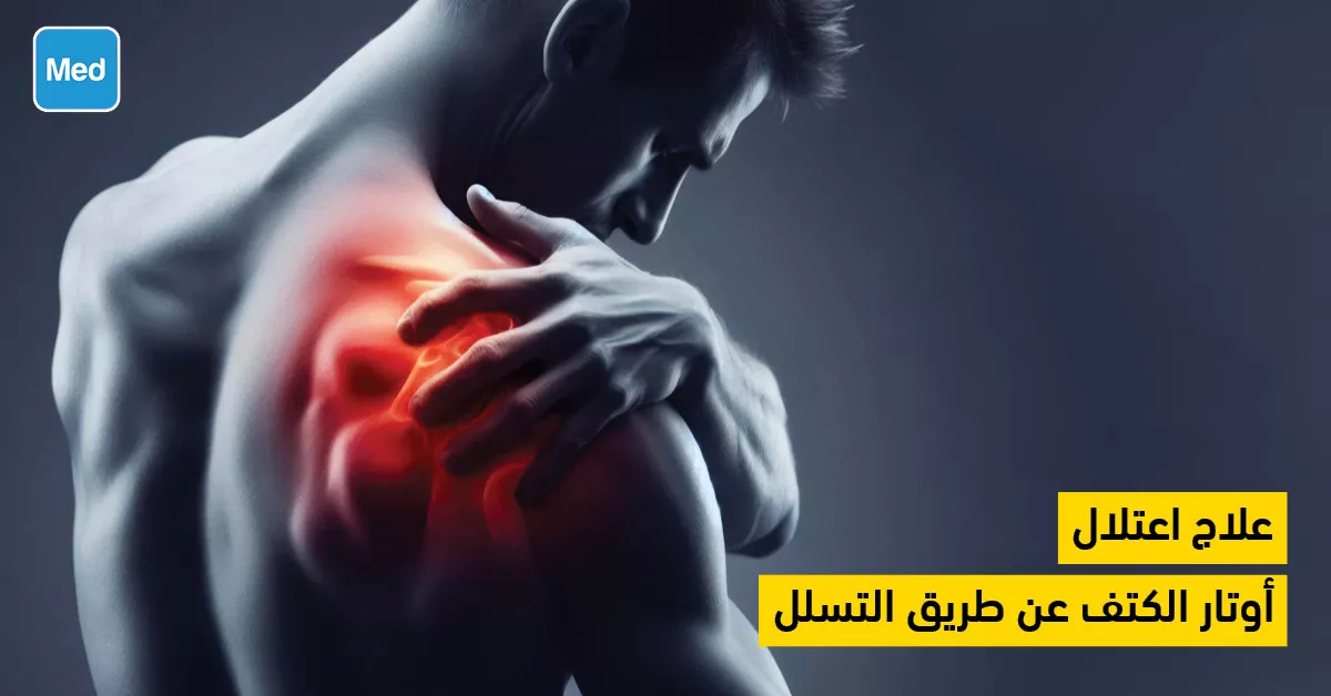 علاج اعتلال أوتار الكتف عن طريق التسلل